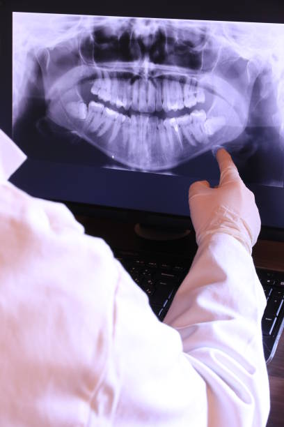 Best Emergency Wisdom Teeth Removal in Oakland, NJ